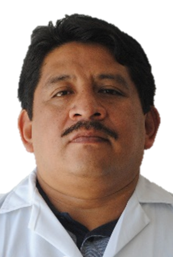 Alberto